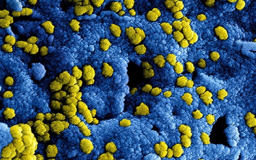 WHO theo dõi sát virus corona mới sau trường hợp mắc bệnh đầu tiên ngoài Trung Quốc